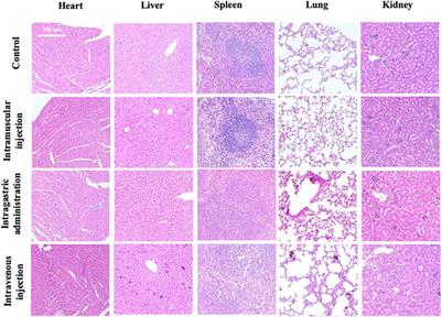 RNA-Seq Based Toxicity Analysis of Mesoporous Polydopamine Nanoparticles in Mice Following Different Exposure Routes